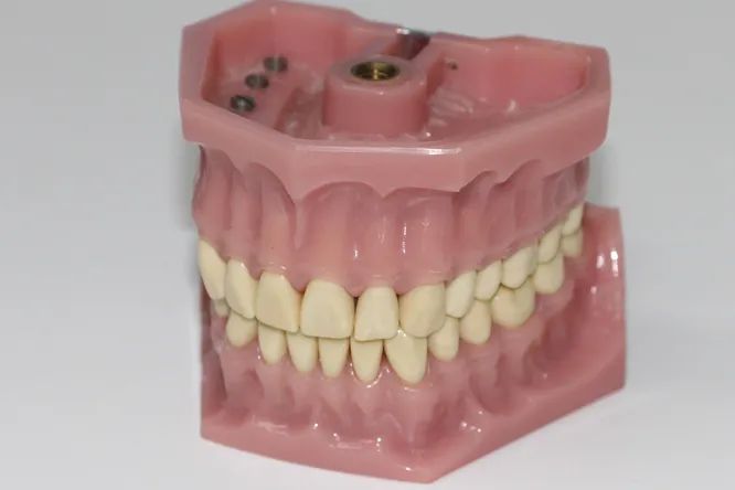 Найден способ отрастить новые зубы