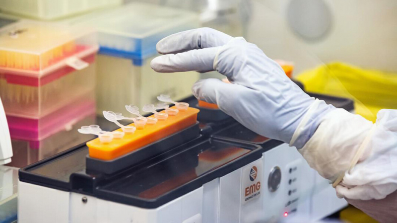 В России впервые выявили южноафриканский штамм коронавируса. Он заразнее других