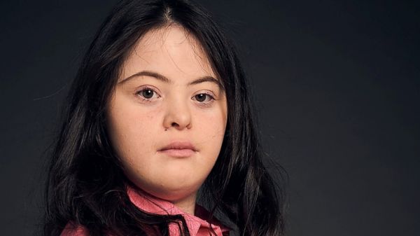 Модель Элли Голдстейн с синдромом Дауна стала звездой кампании Gucci и появилась на страницах Vogue