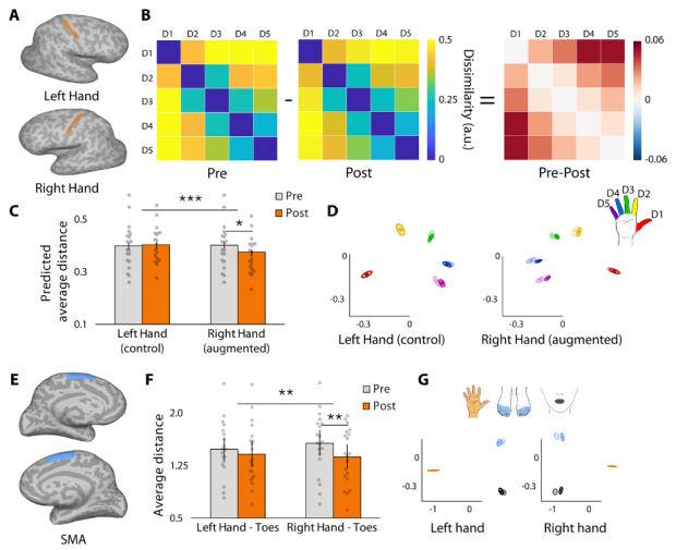 Дополнительный палец изменил представление руки в мозге