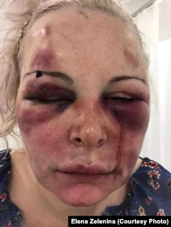 "Мне проще тебя убить, чем с тобой разводиться". Как жертвы домашнего насилия пытаются добиться защиты от агрессоров