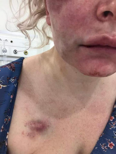 "Мне проще тебя убить, чем с тобой разводиться". Как жертвы домашнего насилия пытаются добиться защиты от агрессоров