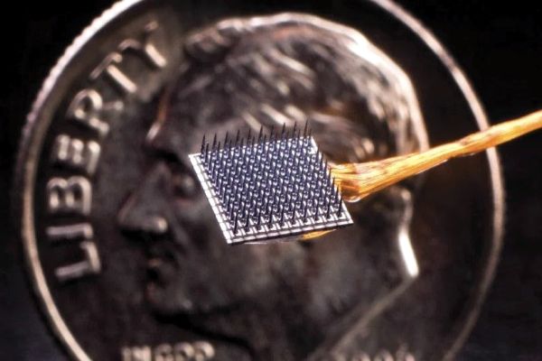 Новый имплантат позволил парализованному писать текст с почти нормальной скоростью