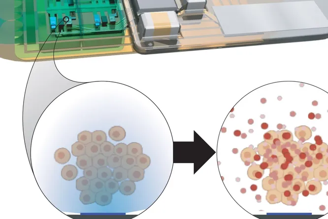 Ученые разрабатывают имплант, который будет контролировать сон человека