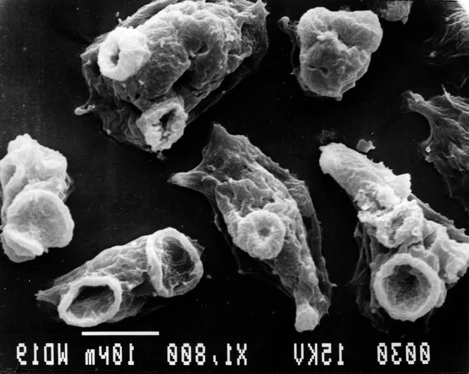 Пожиратель мозга: паразит, питающийся серым веществом человека