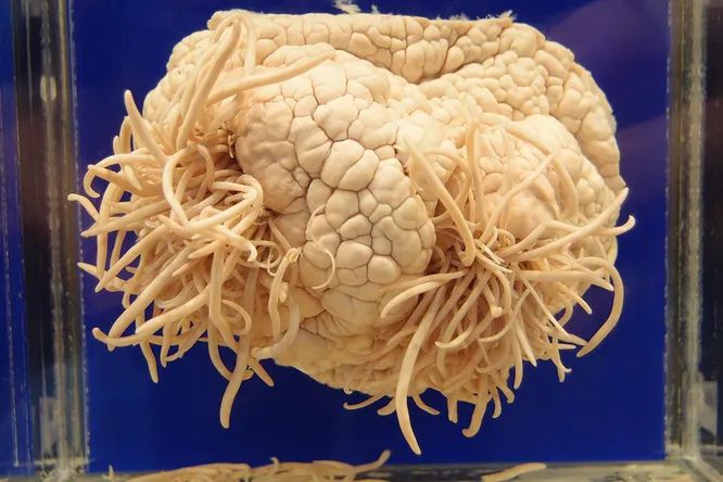 Пожиратель мозга: паразит, питающийся серым веществом человека