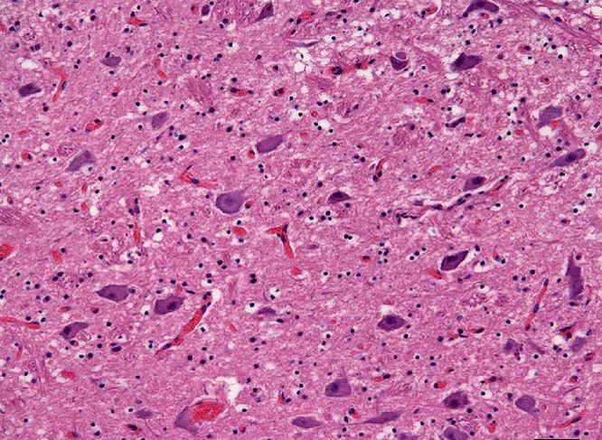 Прионы: чем на самом деле опасны молекулы-зомби