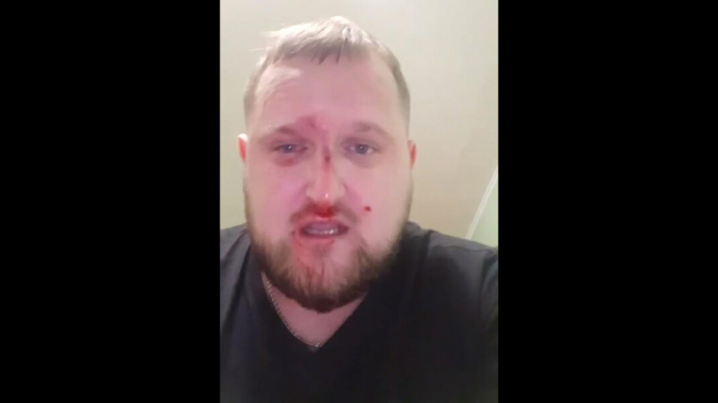 В Благовещенске избили журналиста «Радио Свобода». Он подозревает в нападении местного единоросса