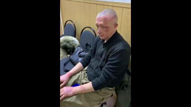 В Пензе возбудили уголовное дело из-за давления на потерпевшего от пыток в СИЗО