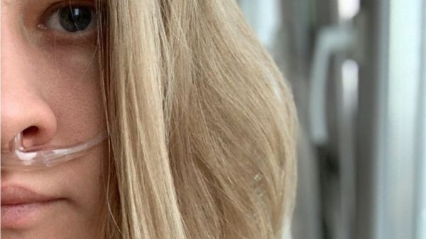 "Ожидание хуже самой смерти". Почему в России задерживают операции по трансплантации легких