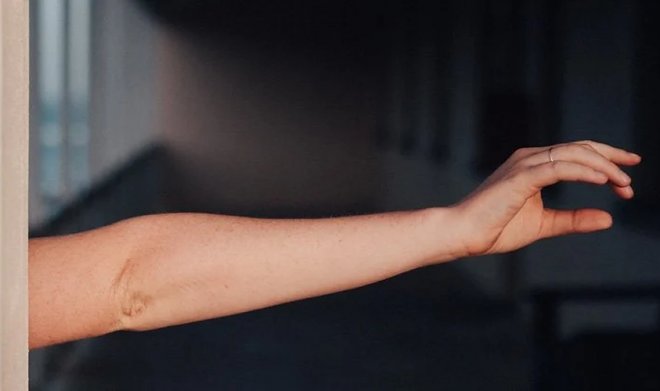 Эволюция человека продолжается – у множества людей появляется дополнительная артерия