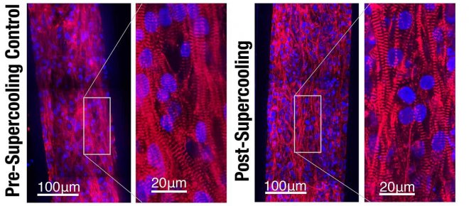 Ученые заставили рукотворное сердце биться после глубокой заморозки