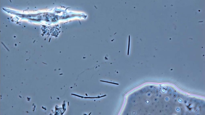 Чилийские ученые испытывают бактерии, которые за три дня съедают металлический гвоздь