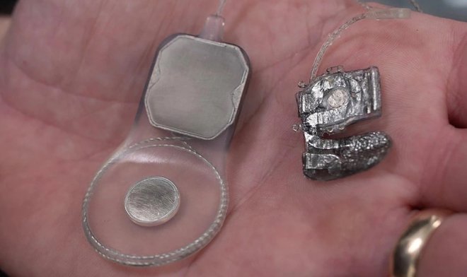 Бионический глаз Phoenix99 готов к испытаниям на людях