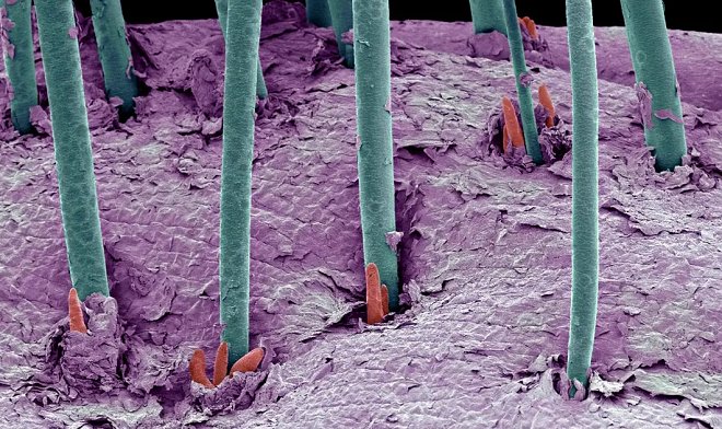 Биоинженеры dNovo научились выращивать на мышах волосы для пересадки людям