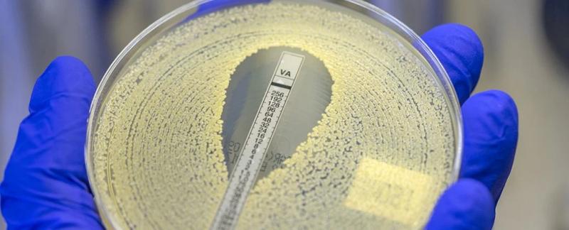 Третья ведущая причина смерти в мире - это, скорее всего, не то, что вы думаете