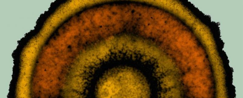 Ученые заметили жутко сложные узоры в колониях "простых" бактерий