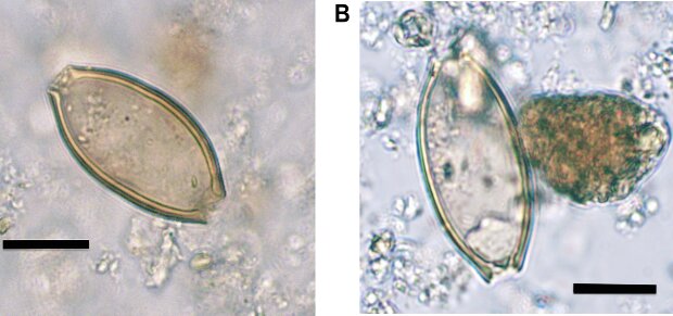 Палеопаразитологи нашли в древнеримском ночном горшке яйца кишечных паразитов