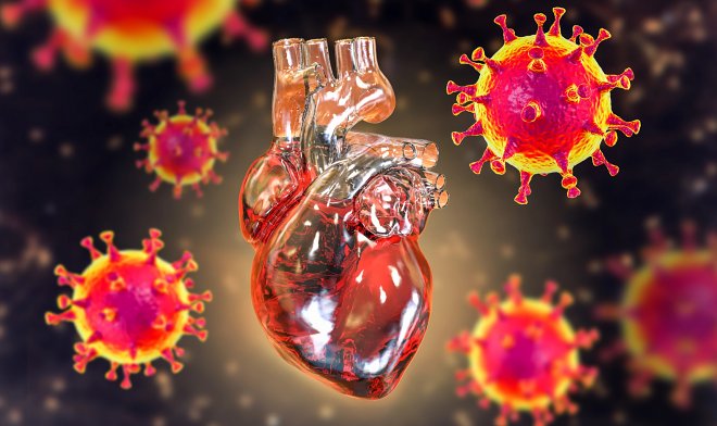Перенесенный ковид многократно повышает риск сердечно-сосудистых заболеваний