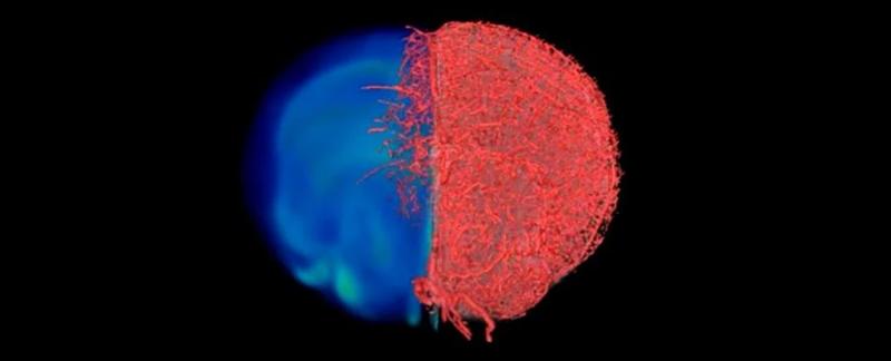 Новая техника визуализации показывает кровеносные сосуды как никогда раньше