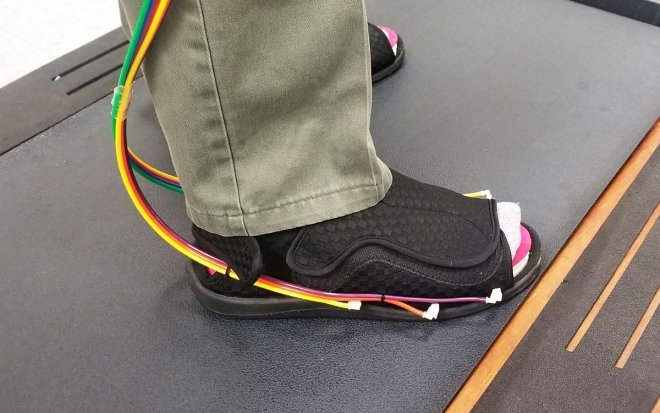 Стельки с управляемым давлением помогут в профилактике диабетической стопы