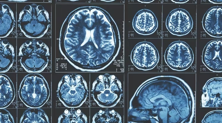 Что такого в человеческом мозге, что делает нас умнее других животных? Новое исследование дало интригующий ответ