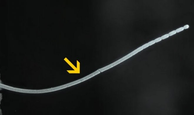 Ученые нашли самую крупную бактерию в мире — ее можно взять в руку