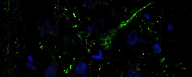 Ученые обнаружили удивительные различия в нейронах между приматами и не приматами