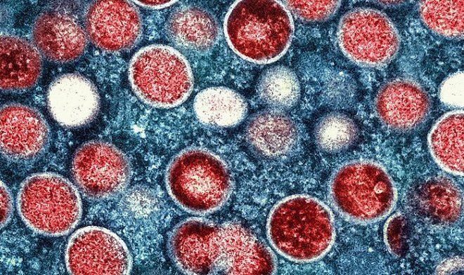 ВОЗ объявила вспышку обезьяньей оспы чрезвычайной ситуацией мирового значения