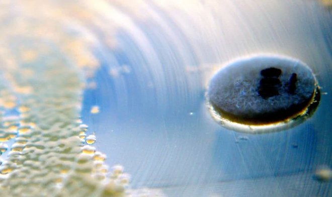 Колония бактерий готова совершить суицид, лишь бы не кормить нахлебников