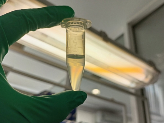 Ученые подсадили человеческие клетки к дрожжам