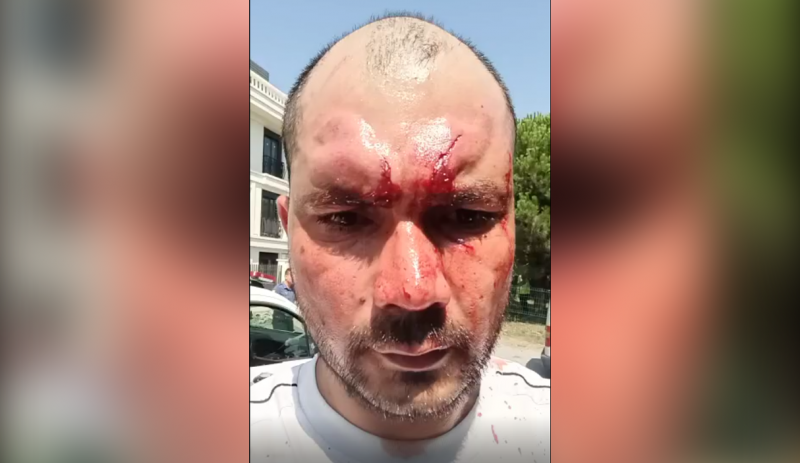 В Турции сотрудники консульства Туркменистана избили активистов и адвоката. Они хотели передать письмо президенту Сердару Бердымухамедову