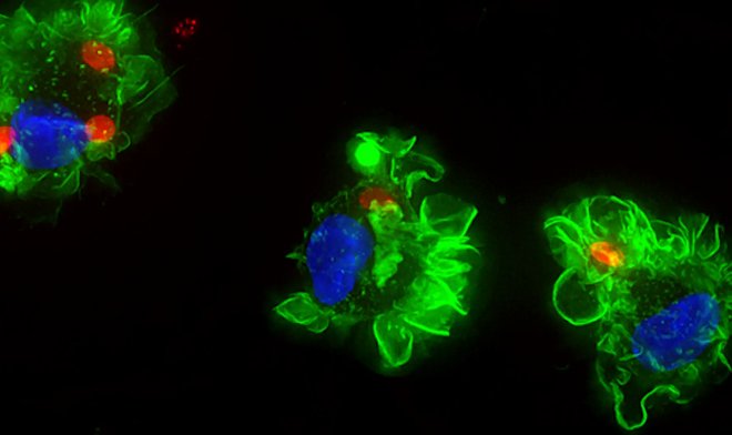 Токсоплазма использует для заражения людей тактику «обратного троянского коня»