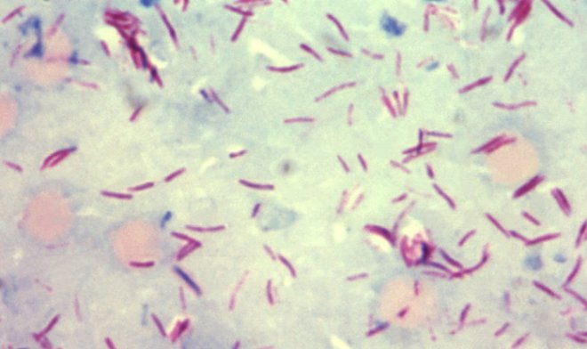 Возбудители проказы оказались способны регенерировать клетки печени 