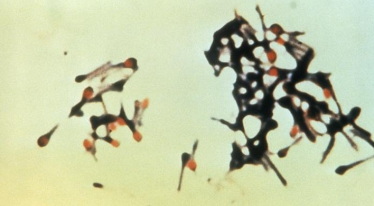 Столбнячная палочка из шеститысячелетней мумии вызвала паралич у мыши