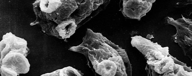 Заразиться «поедающей мозг» амебой можно в бассейне