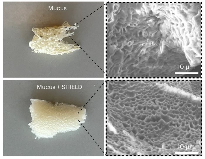 Вдыхаемый порошок SHIELD создаст в легких эффективную защитную оболочку против Covid-19