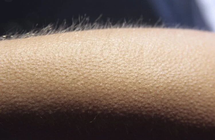 Почему у людей не растет шерсть — самые популярные гипотезы