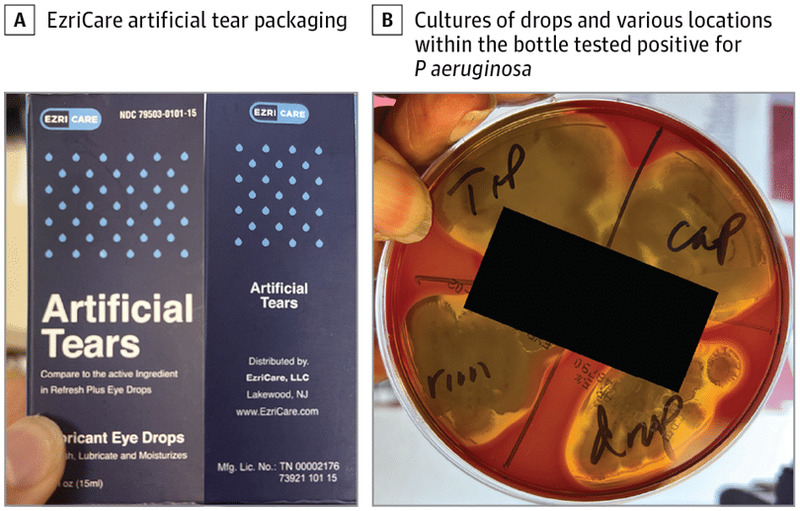 В США растет число погибших от глазных капель, зараженных синегнойной палочкой