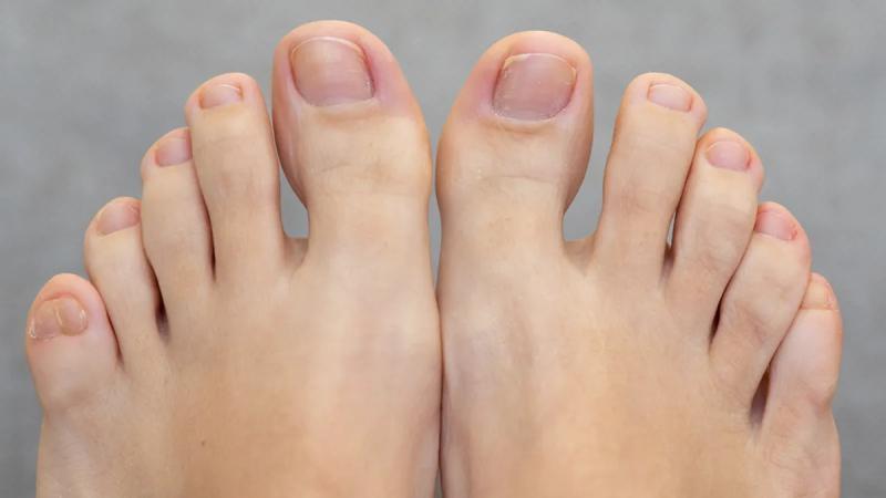 Палец ноги: маленький, но важный
