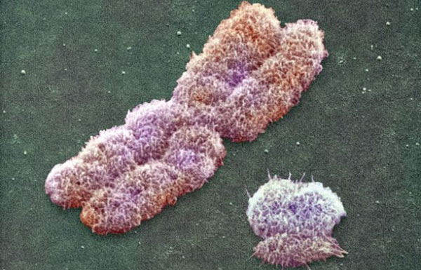 Y-хромосома человека намного старше, чем считалось ранее