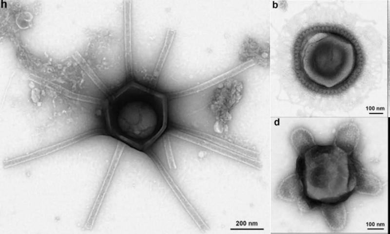 Гигантские вирусы с «невообразимыми» свойствами обнаружены в США