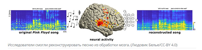Музыку восстановили из сигналов мозга: исследователи реконструировали песню Pink Floyd