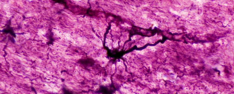 Обнаружены странные "гибридные" клетки мозга, скрывающиеся в наших головах