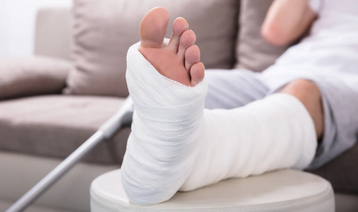 Пьезоэлектрический &laquo;костный бандаж&raquo; значительно ускоряет срастание костей