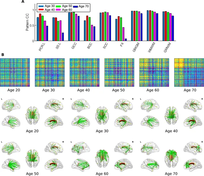 Стареющий мозг имеет свои преимущества, наверно, это и есть мудрость