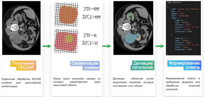 VisionLabs разработала технологию распознавания злокачественных образований почек на снимках КТ