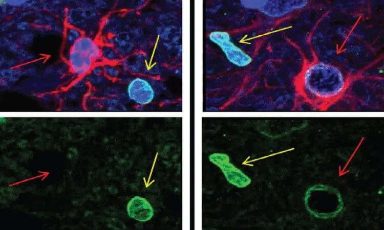 Что такое зомби-нейроны и как они помогают мозгу учиться?