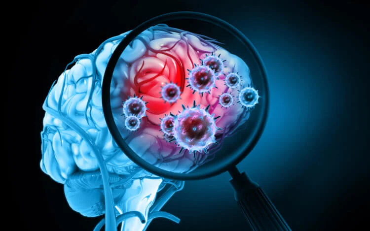 Что такое зомби-нейроны и как они помогают мозгу учиться?