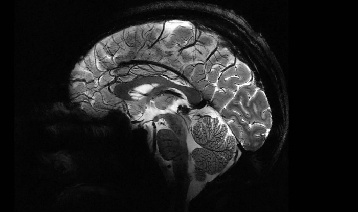 Самый мощный в мире МРТ-аппарат Iseult в несколько раз превзошел конкурентов